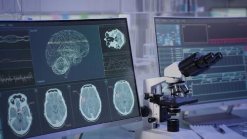 ضبط یك سیگنال مغزی با فناوری كوانتومی برای اولین بار