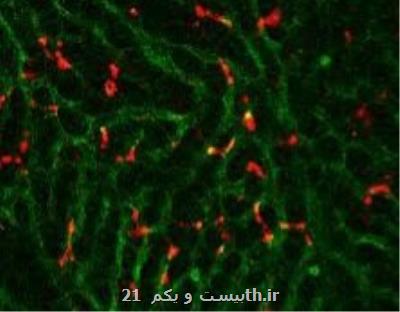 نانوذرات لیپیدی که به درمان سرطان کمک می کنند