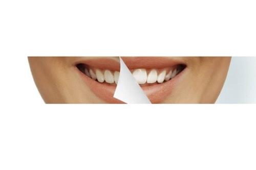 تولید کامپوزیت های دندانی با ثبات رنگ بالا به روشی انحصاری