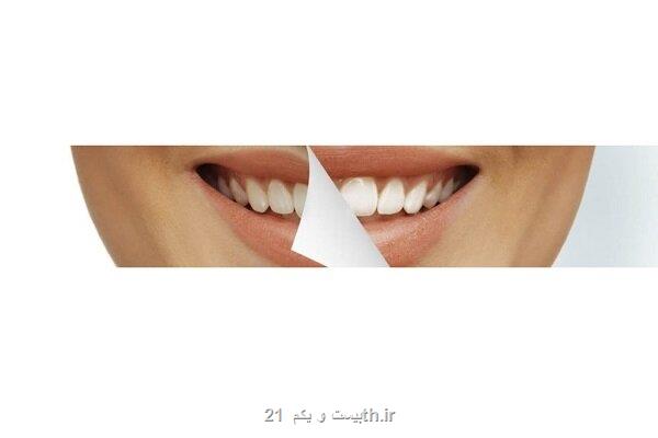 تولید کامپوزیت های دندانی با ثبات رنگ بالا به روشی انحصاری