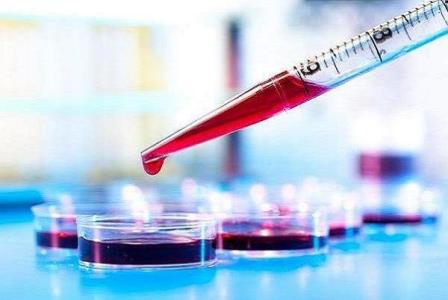 آزمایش خون ریسك مبتلاشدن به دیابت را پیش بینی می كند
