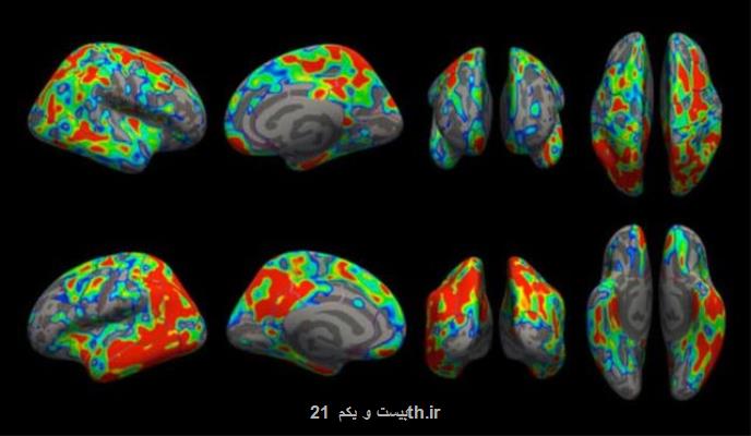 مشاهده میزان از بین رفتن سیناپس های مغز در مراحل اولیه آلزایمر